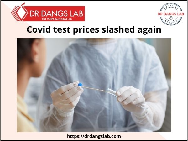 covid test prices slashed